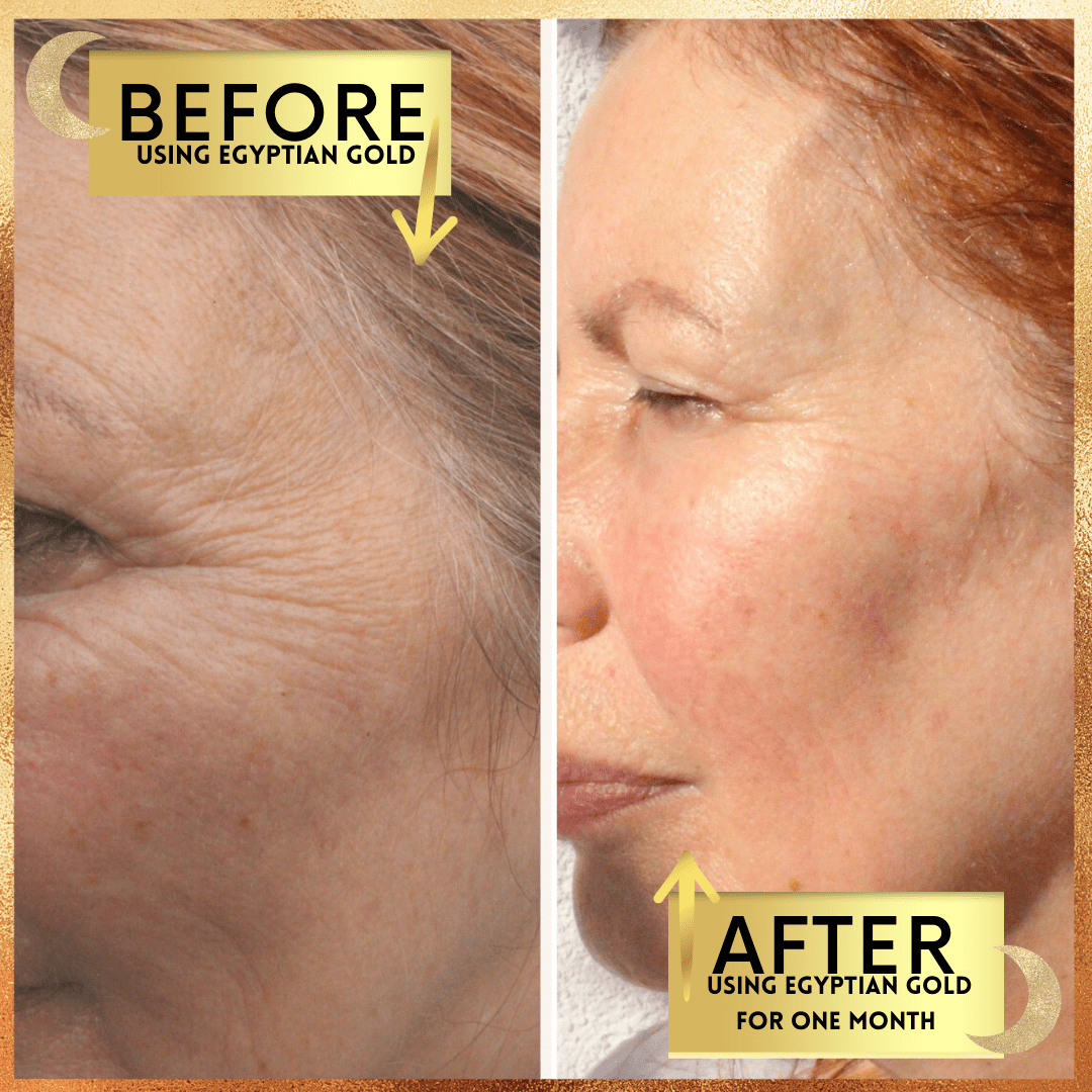 Before and after comparison of skin using Egyptian Gold, showing visible improvement.